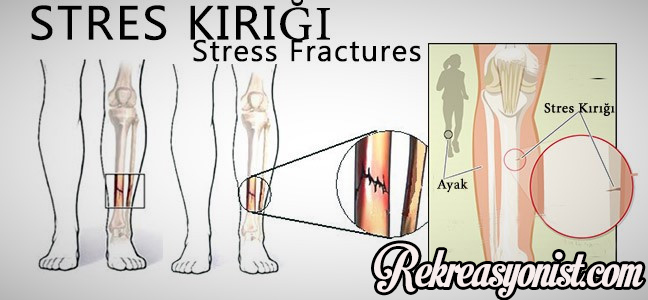 BESYO'da Stres Kırığı