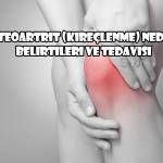 Osteoartrit (kireçlenme) nedir? Belirtileri ve Tedavisi