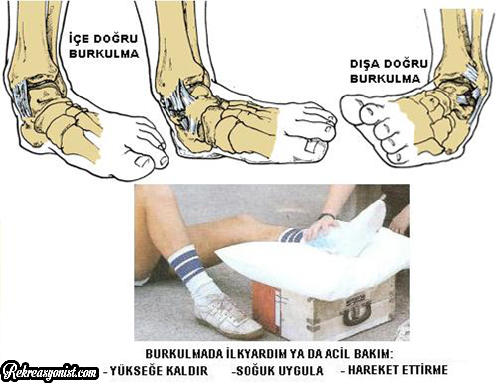 burkulma nedir