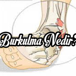 burkulma nedir