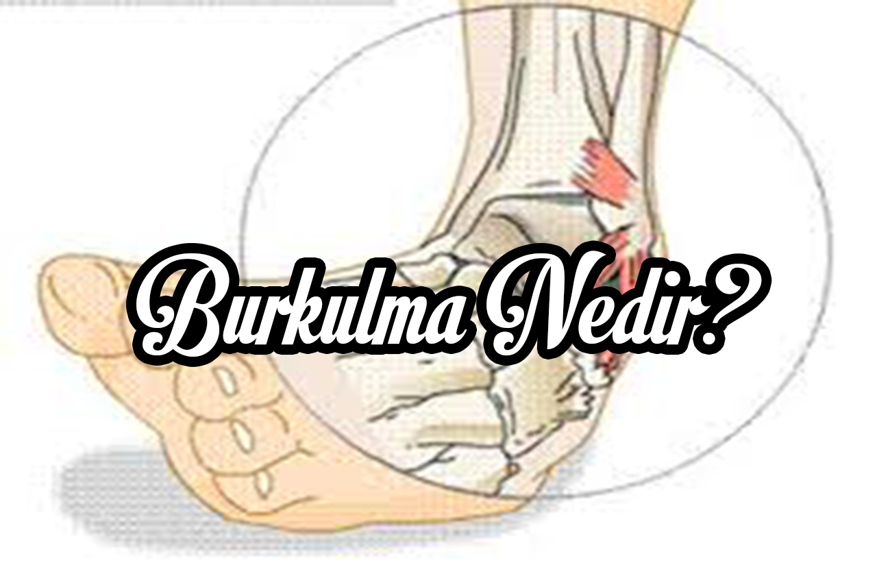 burkulma nedir