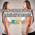 Cushing Sendromu nedir