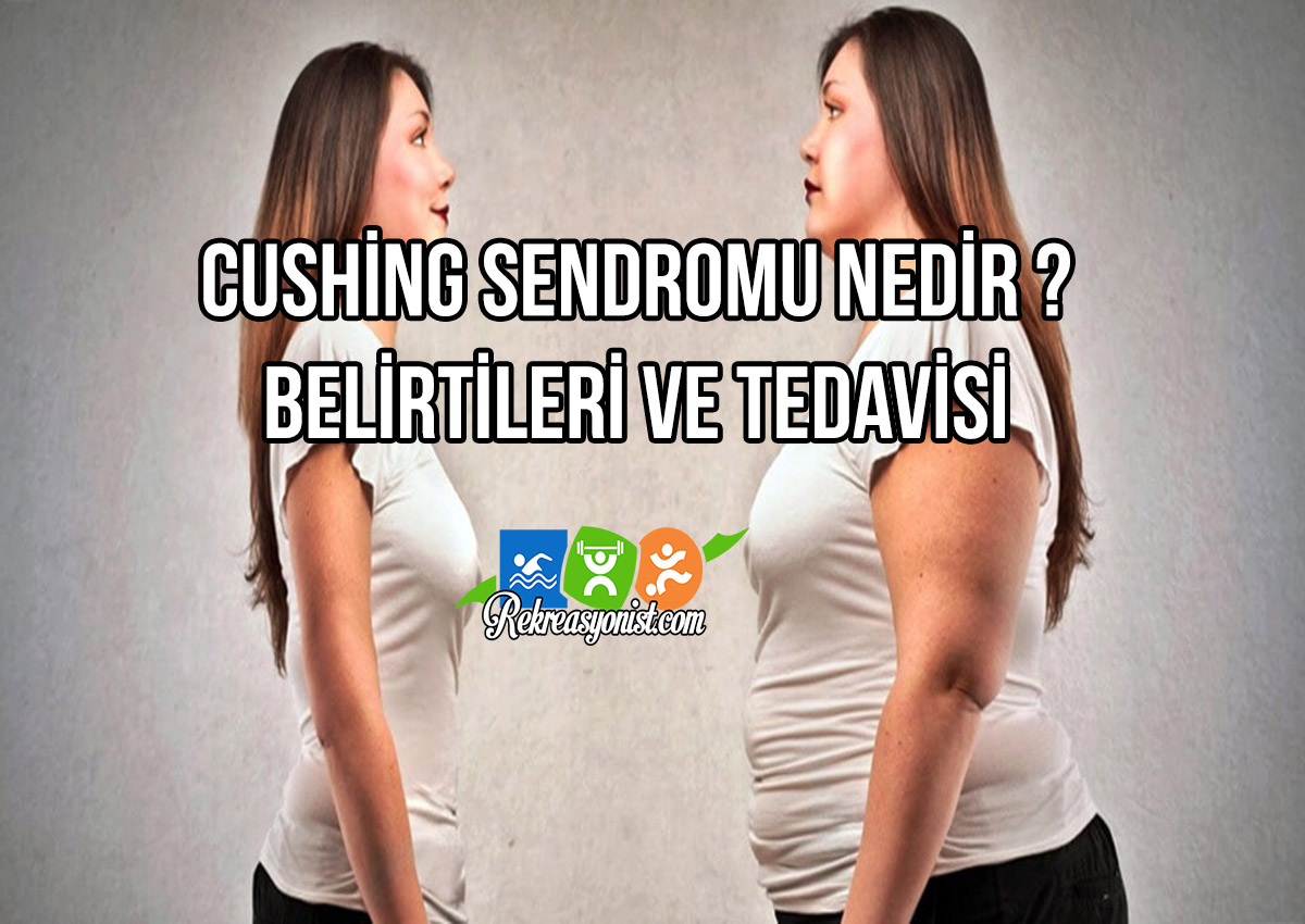 Cushing Sendromu nedir